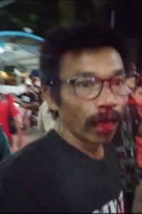 Wajah Manaya Manabun usai disundul satpam SP Plaza, Sagulung - Kota Batam. (Foto: JP - BATAMPENA)