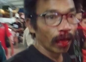 Wajah Manaya Manabun usai disundul satpam SP Plaza, Sagulung - Kota Batam. (Foto: JP - BATAMPENA)