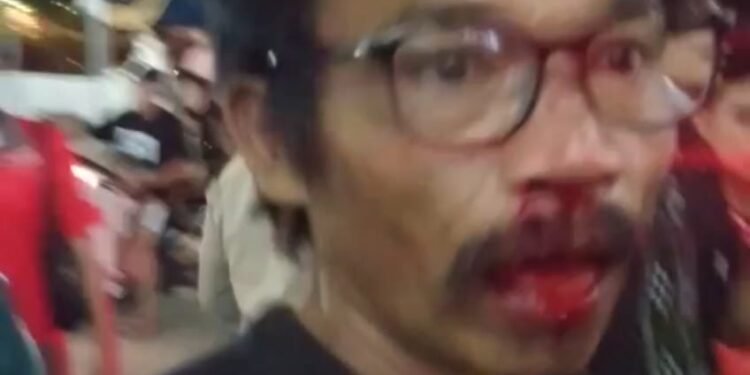 Wajah Manaya Manabun usai disundul satpam SP Plaza, Sagulung - Kota Batam. (Foto: JP - BATAMPENA)