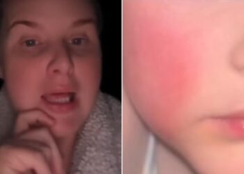 Daycare Horror: Mom’s Fury Over Daughter’s Terrifying Transformation