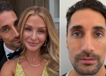 Hugo’s Post-Millie Invisible Facelift: A £3,300 Malaysian Glow-Up