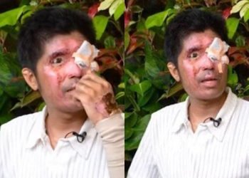 Agus Salim Pilu Ditinggal Istri Kabur Usai Disiram Air Keras