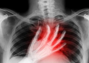 Aussie Cardiologist’s Top Heart Warning Sign