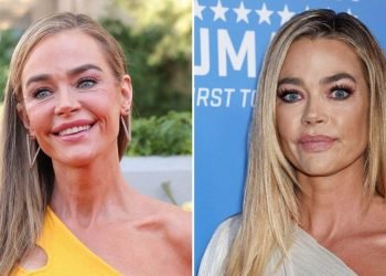 Denise Richards ‘Terrified’ Before 2025 Facelift: ‘Couldn’t Hide It’
