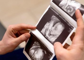 Janin Tidak Berkembang, Apakah Perut Tetap Membesar?