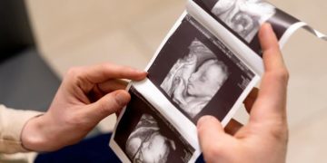 Janin Tidak Berkembang, Apakah Perut Tetap Membesar?