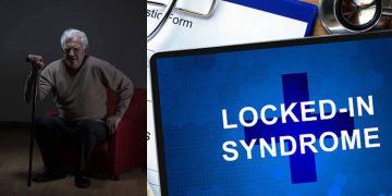 Why can’t you stand up after sitting? Rare brain condition revealed