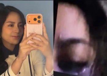 Mata kiri Rachel Vennya jadi sorotan, foto lebam viral di media sosial