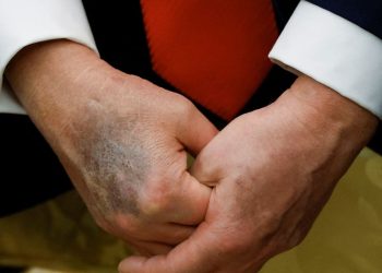 MAGA’s Myth: Why They Buy Trump’s Health ‘Perfection’