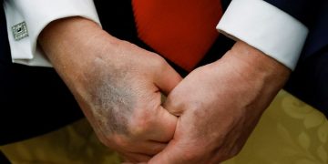 MAGA’s Myth: Why They Buy Trump’s Health ‘Perfection’