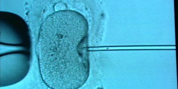 Victoria Tightens IVF Scrutiny Post-Monash Bungles