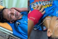 Vicky Prasetyo Terbayang Pesan Anak Dede Sunandar Usai Lawan Berujung Blackout di Jambi